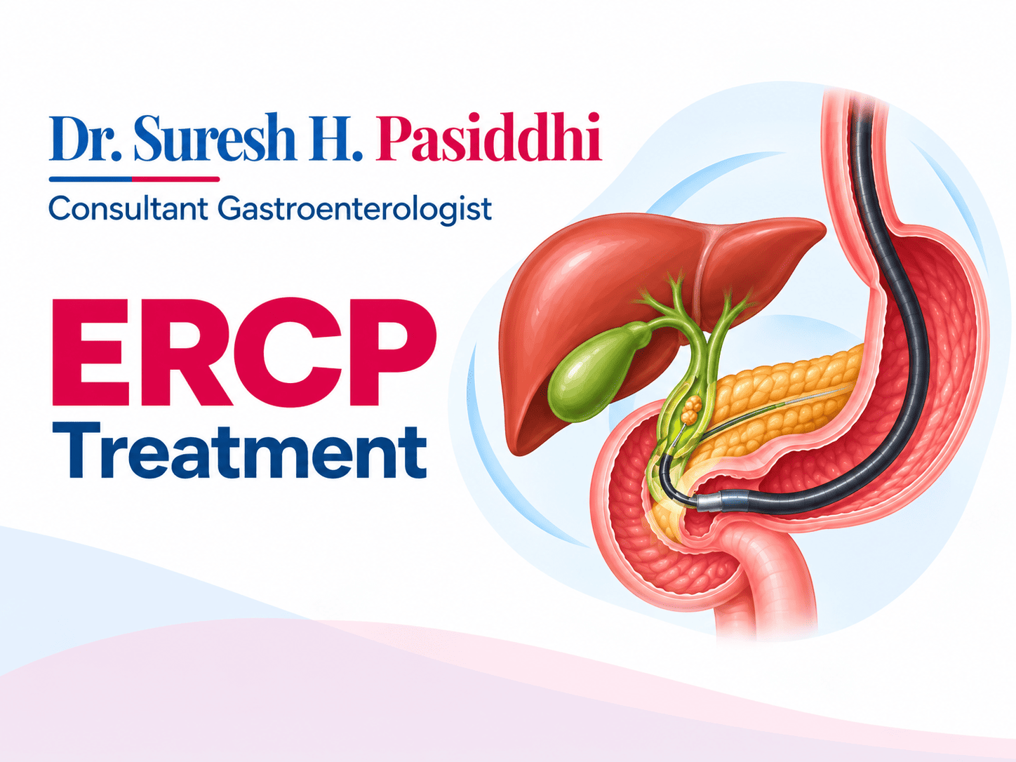 ERCP Doctor in Chembur