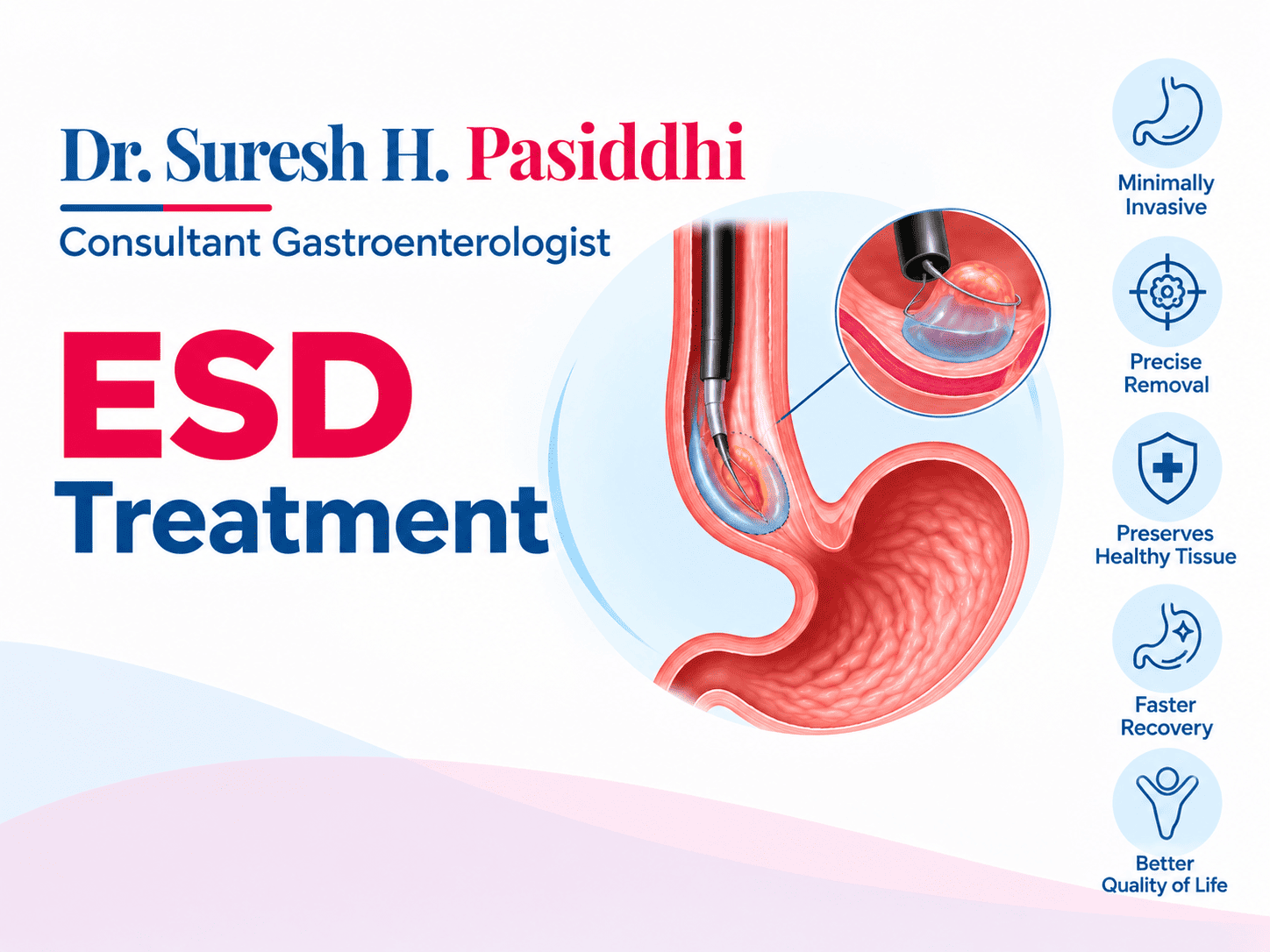 ESD Treatment in Chembur